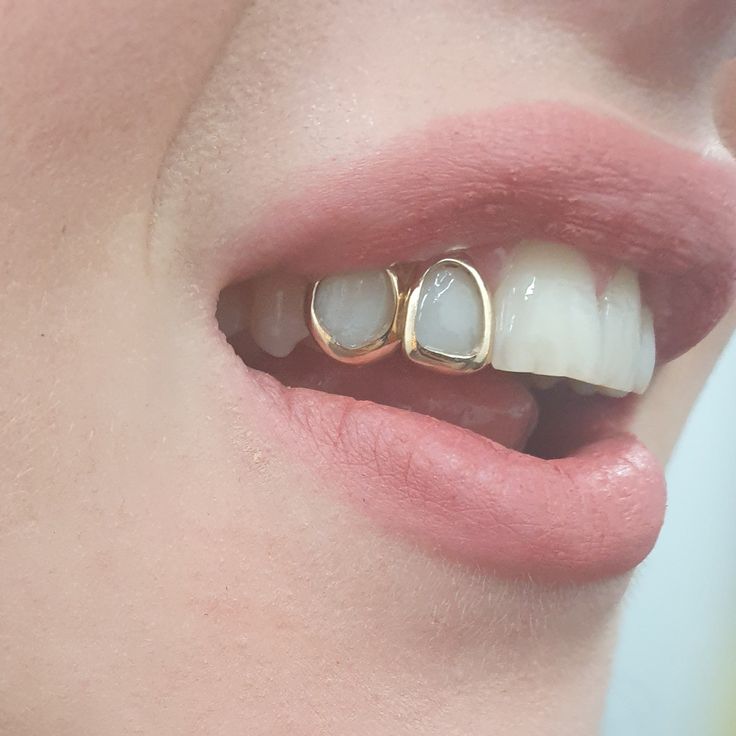 grillz